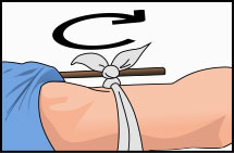 Arm with cloth tied with knot below and on top of stick with arrow indicating a circle going clockwise
