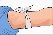 Parte alta del brazo con un trozo de tela atado